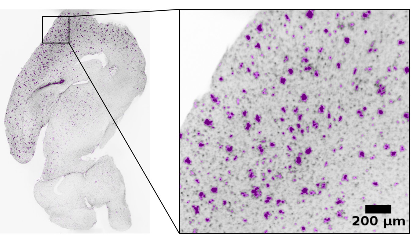 Microglia Segmentation in Drug Efficacy Studies