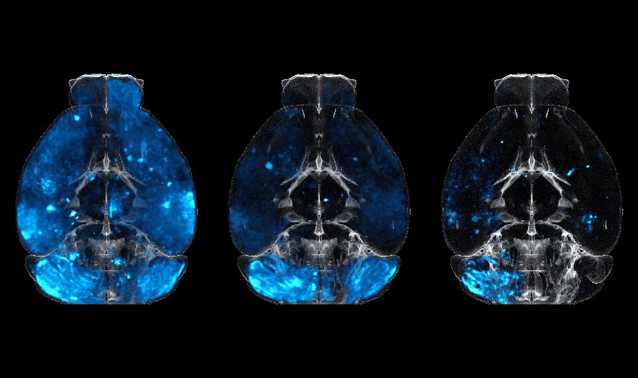 Neuronal Cell Segmentation in Whole Mouse Brains